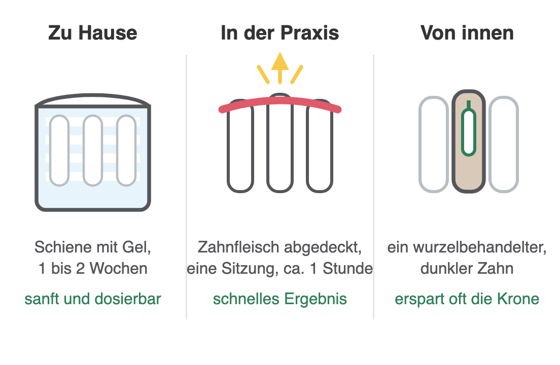 Schema der drei Bleaching-Verfahren: Home-Bleaching mit Schiene, Bleaching in der Praxis, internes Bleaching eines einzelnen Zahns