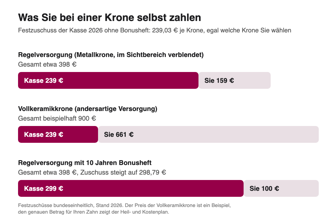 Grafik: Eigenanteil bei einer Zahnkrone, Festzuschuss der Kasse 2026 gegen Gesamtkosten für Regelversorgung, Vollkeramik und Bonusheft